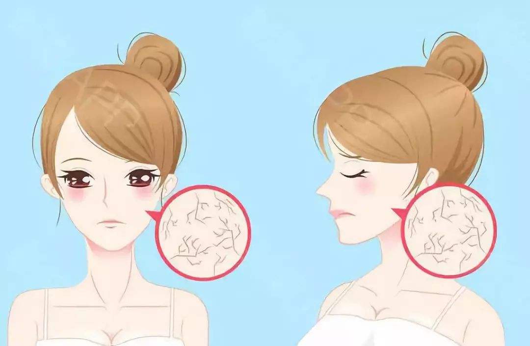 痤疮持续扩大怎么办？原因解析与应对策略