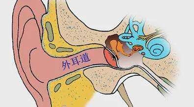 高效快速灌肠法，轻松解决肠道问题