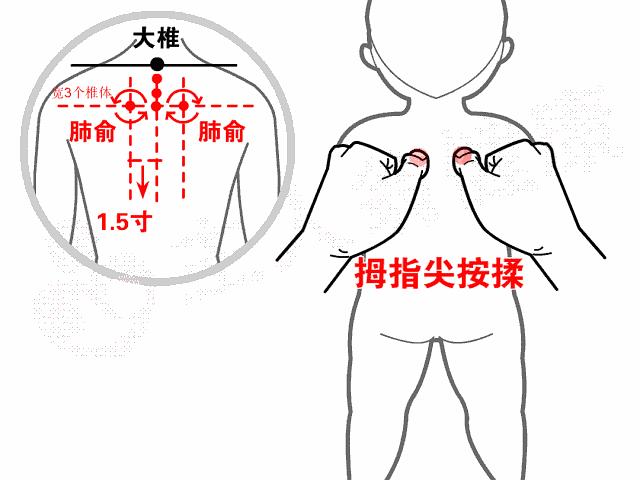 儿童咳嗽全解析，症状、原因与应对方法